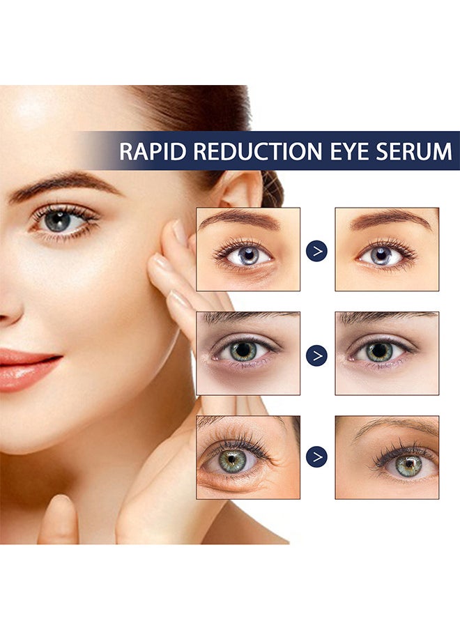 Rapid Reduction Eye Serum, Anti Aging Serum Visibly Reduces Under-Eye Bags, Wrinkles, Dark Circles, Fine Lines And Crow's Feet Instantly