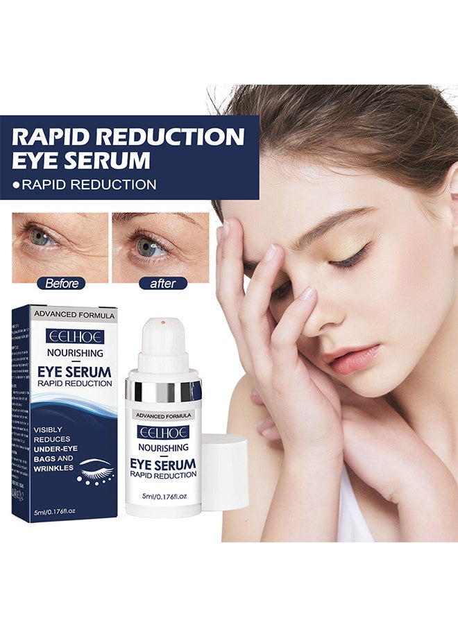 Rapid Reduction Eye Serum, Anti Aging Serum Visibly Reduces Under-Eye Bags, Wrinkles, Dark Circles, Fine Lines And Crow's Feet Instantly