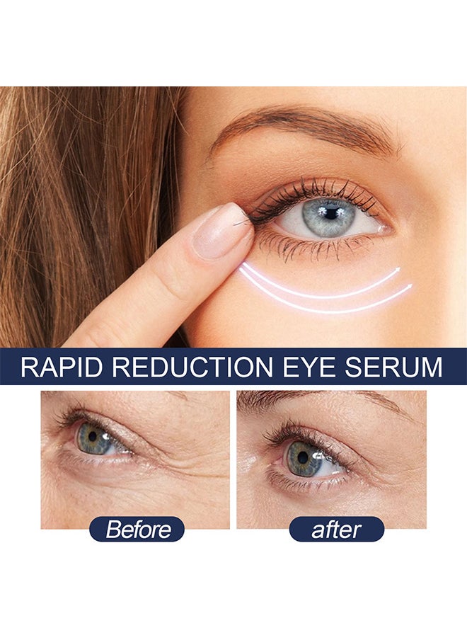 Rapid Reduction Eye Serum, Anti Aging Serum Visibly Reduces Under-Eye Bags, Wrinkles, Dark Circles, Fine Lines And Crow's Feet Instantly