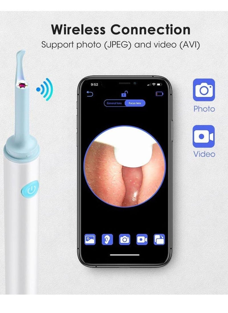 Ear Wax Removal, Wi-Fi Visible Wax Elimination Spoon with Soft Silicone Ear Scoops, Wireless Ear Endoscope 1080p with LED Light for iPhone, iPad, Android Phones