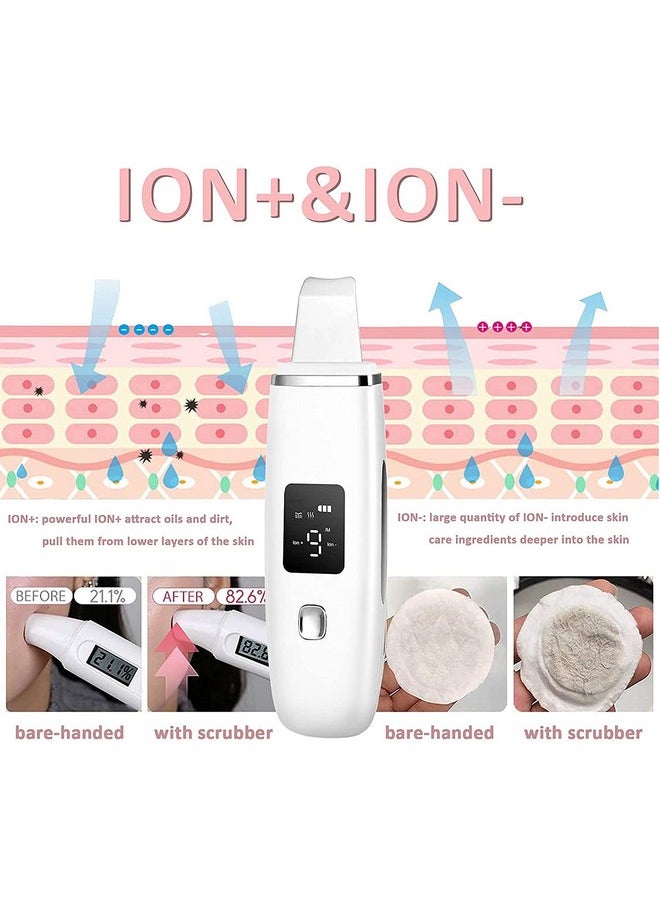 Ultrasonic Shovel Machine For Facial Skin Scrubber Lifting Moisturizing & Cleansing Skin Dirt Blackhead Remover Peeling Tool,Pore And Exfoliator, Comedone Extractor Treatment (Multicolor)