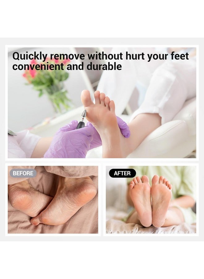 3Pcs 8Mm Diamond Pedicure Cone Drill Bits Set For Cracked Skin Corns Callus Removal, Feet Filing Nails For Manicure And Pedicure