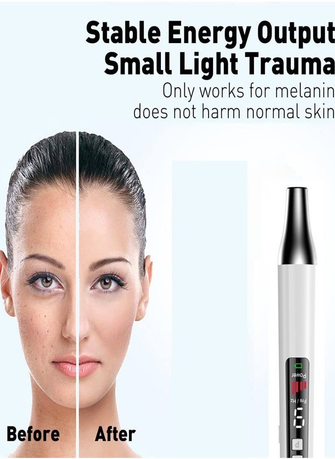 Handheld Laser Picosecond Skin Tattoo Dark Spot Removal Laser Pen Beauty Device（red light）