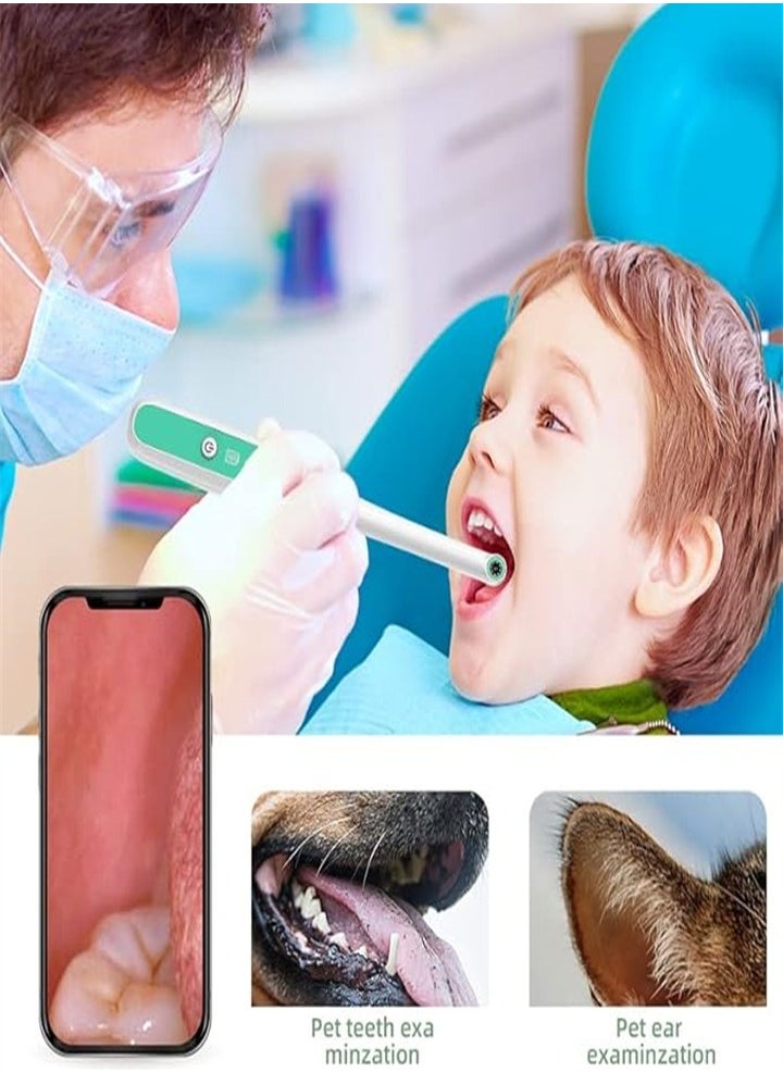 Oral Endoscopy Wireless WiFi Oral Scope Viewer for Dental Dental Examination