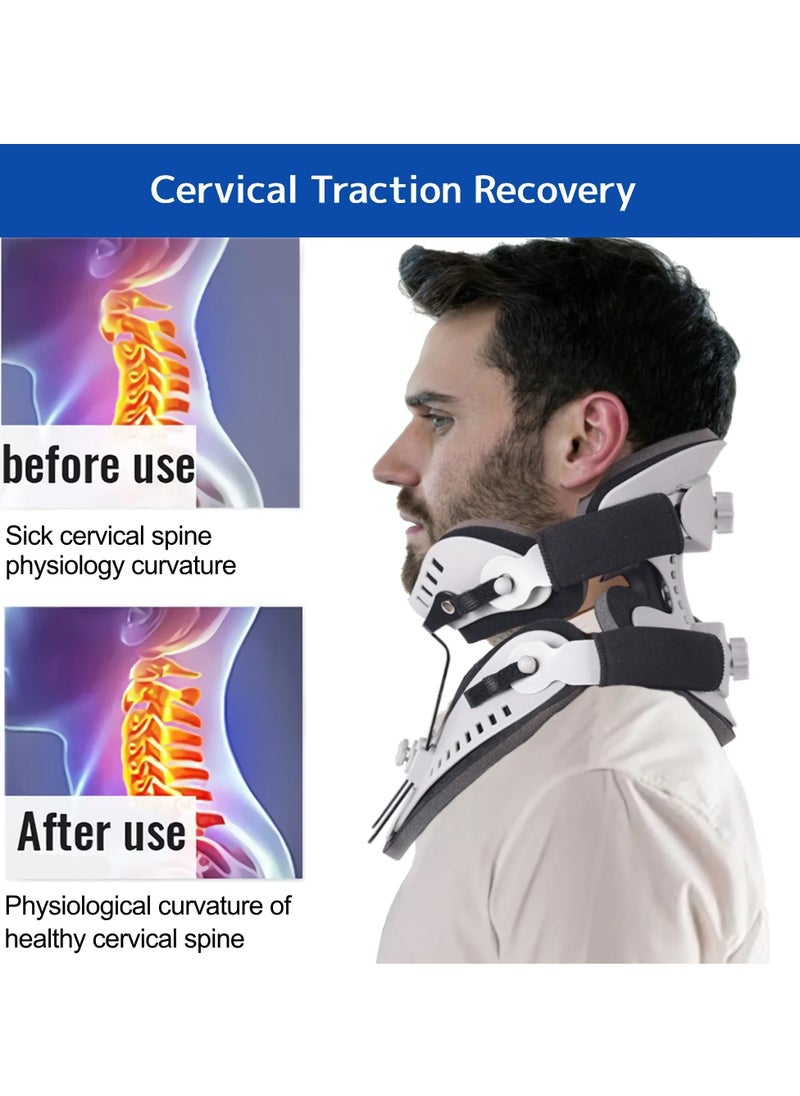 Neck Brace Support,  Adjustable Cervical Collar, Comfortable Fixable Neck Posture Corrector, Neck Pain Spine Pressure Traction Device For Neck Pain Posture Support, (1pc, Grey)