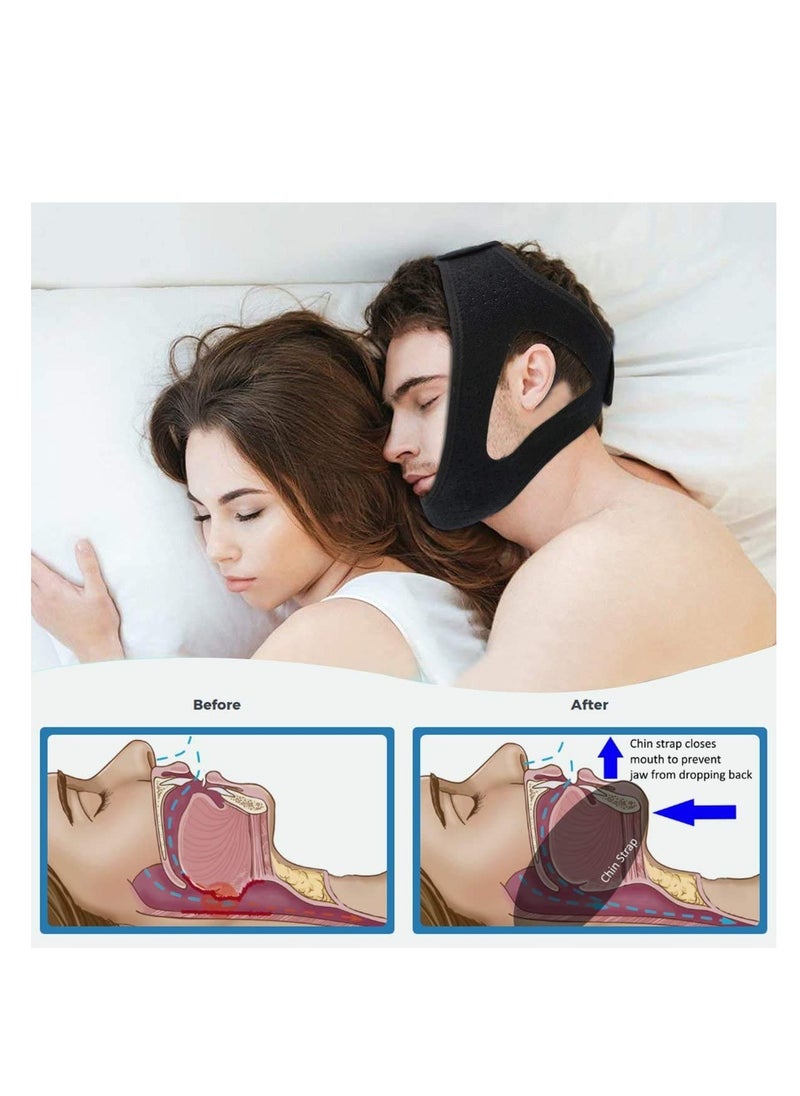 Anti Snoring Chin Strap, Stop Snoring, The Most Effective Snoring Solution, Snoring Reduction Relief Stopper, Sleep Aid Devices Adjustable Comfortable Bands For Men And Women