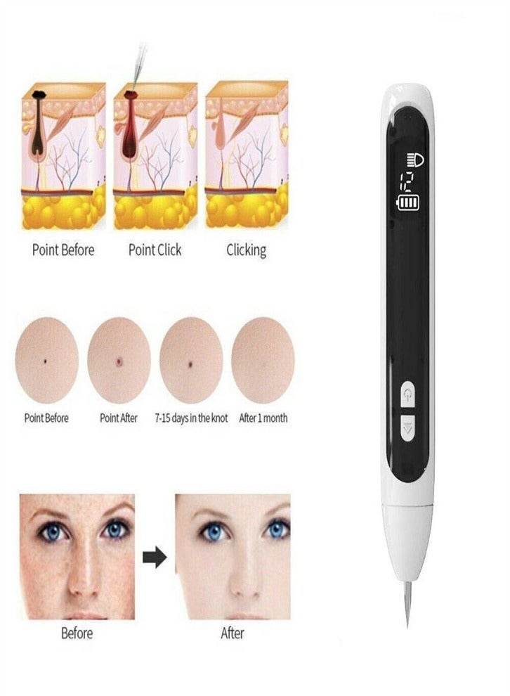 Laser Mole Removal Pen, Portable Skin Tag Removal Pen for Face, Body Warts, Freckles, Mole Spot Treatment and Age Spots