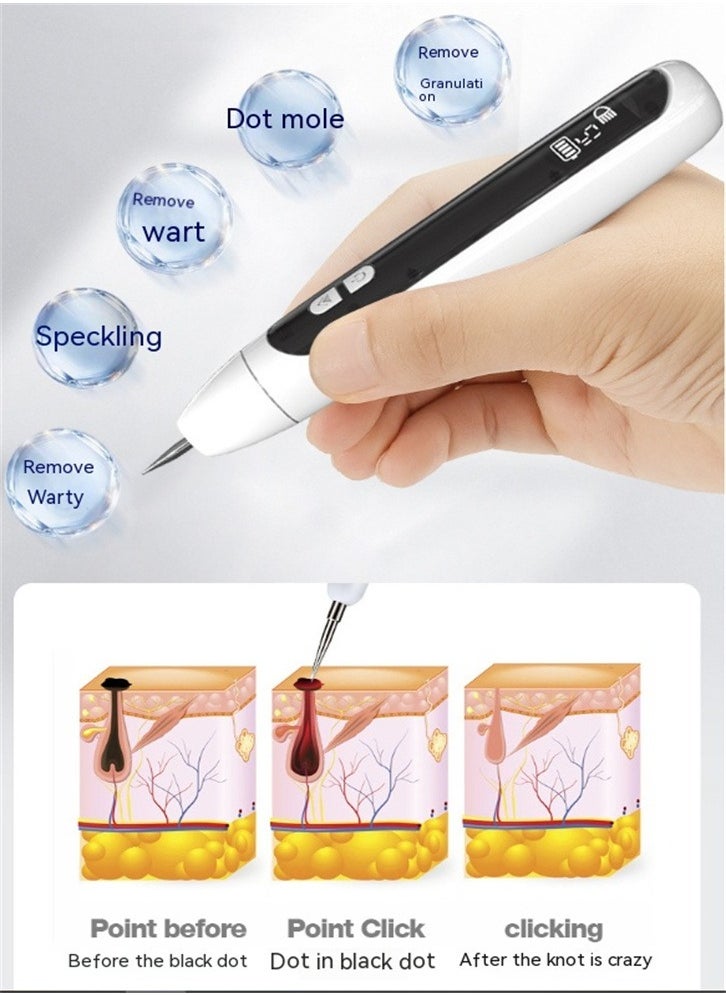 Laser Mole Removal Pen, Portable Skin Tag Removal Pen for Face, Body Warts, Freckles, Mole Spot Treatment and Age Spots