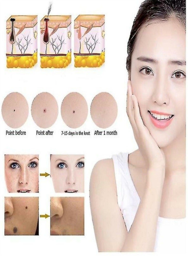 Laser Mole Removal Pen, Portable Skin Tag Removal Pen for Face, Body Warts, Freckles, Mole Spot Treatment and Age Spots