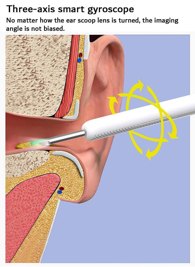 Ear Wax Removal, Wi-Fi Visible Ear Cleaner Kit with 12 Ear Pickers and Storage Case, Ear Wax Removal Tool with 1080 HD Camera and 6 Ear Scoops (White)