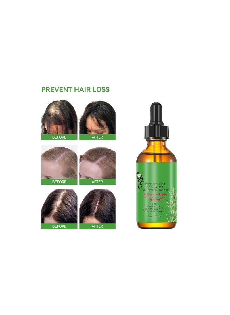 Rosemary Hair Growth Oil and Serum - Dry Scalp Treatment, Hair Thickening Products for Women, Hair Loss Essential Oils for Diffuser (2OZ)