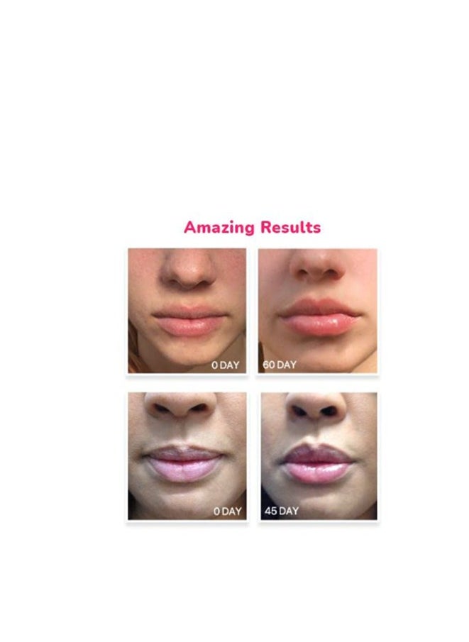 LifeCell Lip Plumping Treatment