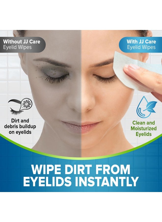 Eyelid Cleaning Wipes 80 Pcs, Individually Wrapped Eye Lid Scrubbing Wipes, Moisturizing Eye Wipes For Irritated, Itchy, And Dry Eyes, Hypoallergenic Eye Scrub Cleaning Pads