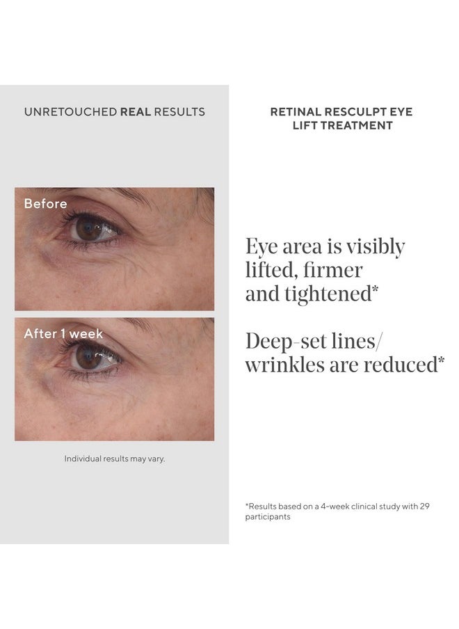 Retinal Resculpt Eye Lift Treatment - Anti-Aging Eye Cream Lifts And Improves Sagging - Encapsulated Vitamin A Eye Care Firms Droopy Eyelids, Reduces Lines And Wrinkles - 0.5 Fl Oz