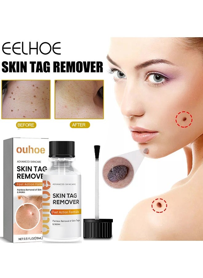 Skin Tag Remover-Painless Skin Tag Remover for Common Hand and Plantar Warts, Extra Strength Wart Liquid, Wart and Mole Remover, Painlessly Removes Common Warts, Safe, Effective and Easy to Use