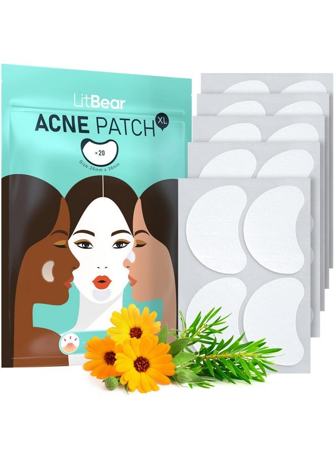 Acne Patches Large, Hydrocolloid Pimple Patches For Large Breakouts, Zit And Blemish, Large Acne Patches For Face, Chin, Back And Body With Tea Tree & Calendula Oil