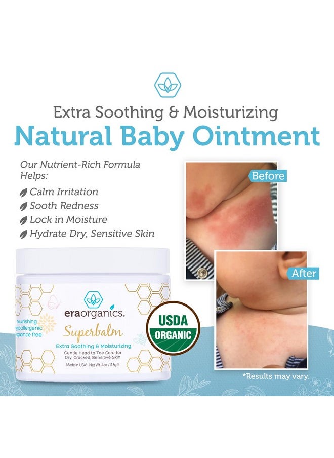 Healing Ointment For Babies - Usda Certified Organic Natural Gentle Moisturizer For Sensitive Skin Prone To Baby Eczema, Cradle Cap (Infant Seborrheic Dermatitis), Rashes & Hives (4 Oz.)