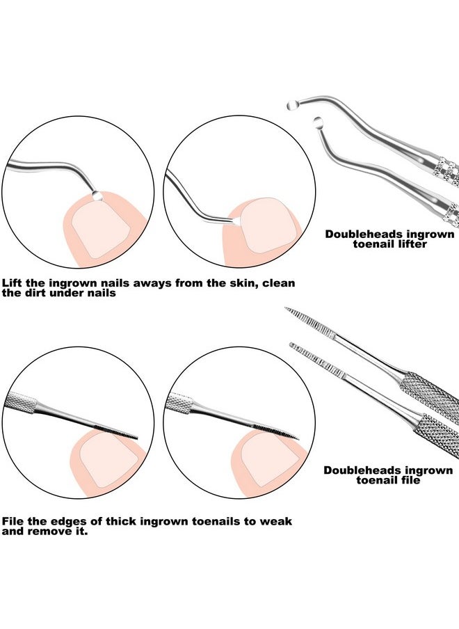 7 Pcs Ingrown Toenail File And Lifters Set, Stainless Steel Ingrown Toenail Removal Kit, Under Nail Cleaner Pedicure Tools