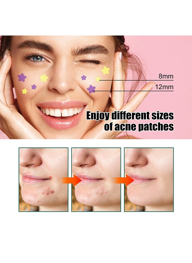 Colorful Acne Patch, Star-Shaped Acne Patch Repair Acne Acne Fade Spots Acne Prints Cover Acne Acne Repair Patch, Star Pimples Repair Acne Blemish Blemish Mark Cover pimples Repair Patch 112 Patches