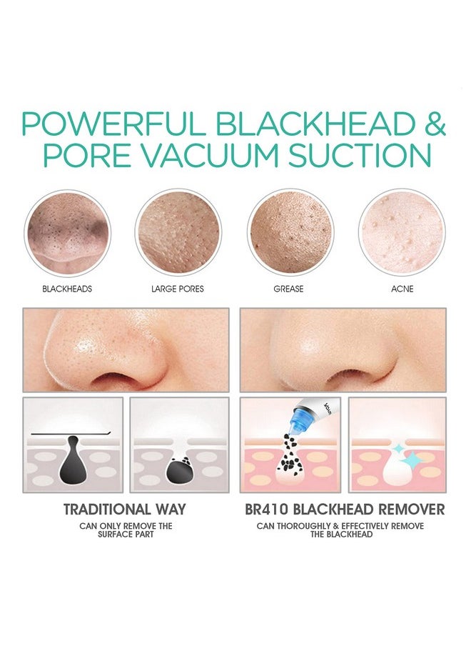 Blackhead Remover Pore Vacuum - Electric Face Vacuum Pore Cleaner Acne White Heads Removal With 6 Suction Heads (Br410)