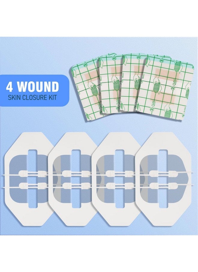 Wound Closure Strips - 4 Pcs - Butterfly Bandaids - Zip Stitch Wound Closure Strips - Laceration Closure Kit - Emergency Laceration Closures - Liquid Stitch - Cut - Incision -Tear- Post Surger