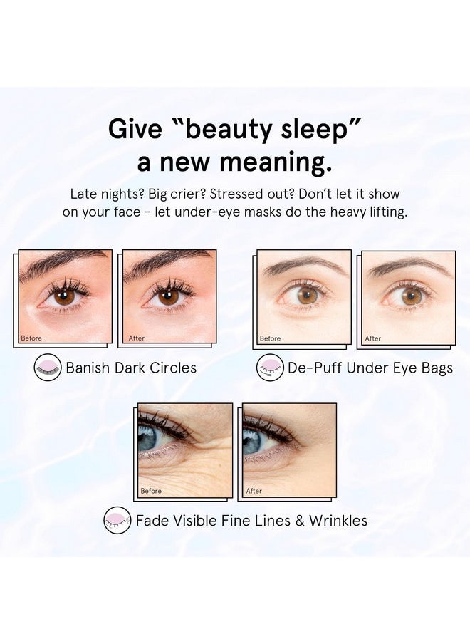 Under Eye Patches For Puffy Eyes And Dark Circles (Retinol, 6 Pairs) Restoring Gel Under Eye Masks With Hyaluronic Acid - Vegan Cruelty-Free Skincare Birthday Gifts For Women