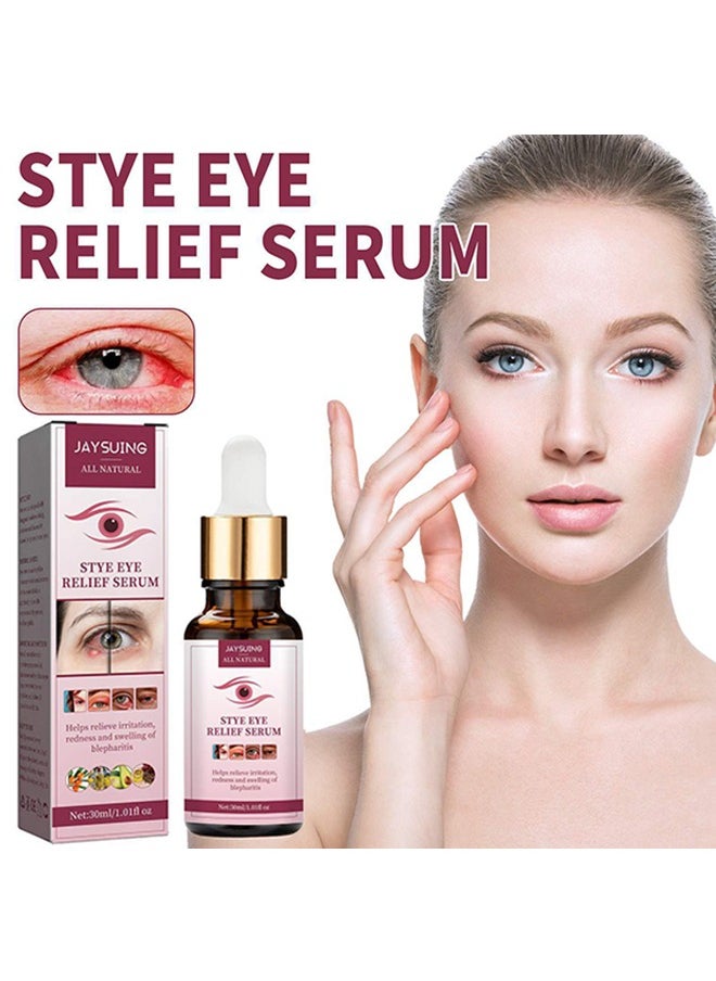 Stye Eye Relief Serum, Stye Eye Treatment, Eye Stye Remover, Chalazion Remover, Stye Eye Relief Serum for Styes Chalazion and Blepharitis Treatment, Eye Care, Mild Lash and Eye Cleanser  30ml