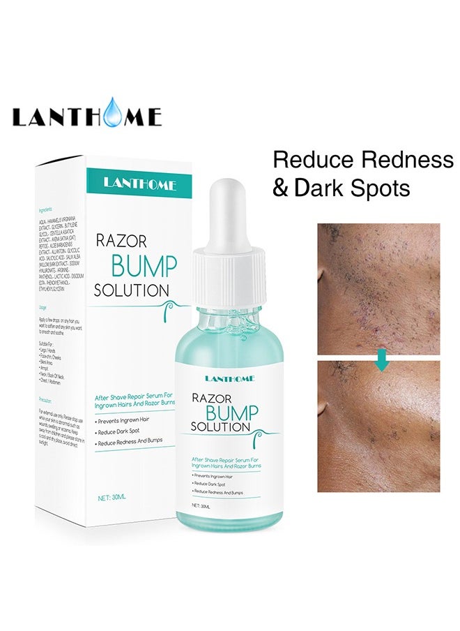 Razor Bump Solution,Hair Growth Inhibitor Safe and Gentle Repair serum, Delay Hair Growth, No Black Spots 30ml