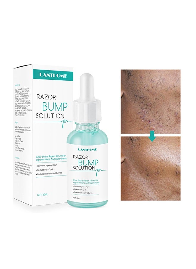 Razor Bump Solution,Hair Growth Inhibitor Safe and Gentle Repair serum, Delay Hair Growth, No Black Spots 30ml