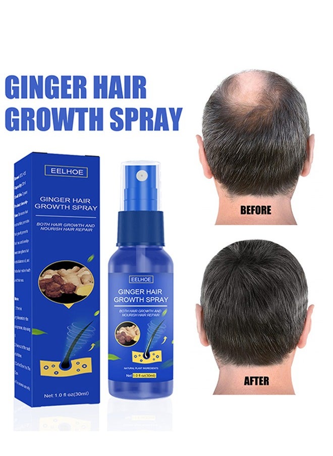 Ginger Hair Growth Spray, Regrowth Nourishing Ginger Spray, Ginger Spray For Hair Growth, Anti Hair Loss, Thinning, Balding, Repairs Hair, Use For Hair Loss and Hair Thinning Treatment Spray 30ML