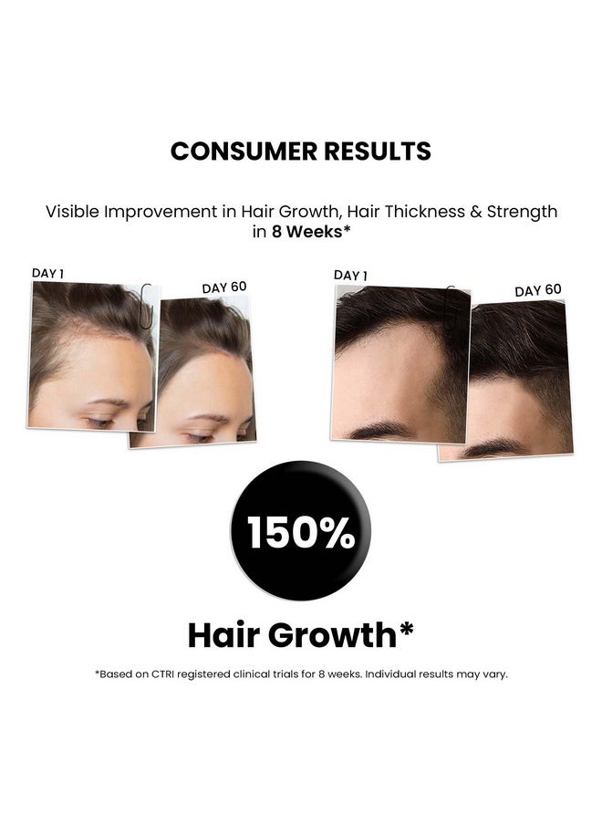 Hair Growth Serum 2.0 For Hair Growth & Hair Fall Control | With Redensyl + Anagain + Rosemary + Procapil + Capilia Longa | For Men & Women | 50Ml (Pack Of 6)