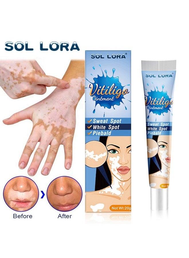 Vitiligo Ointment, Vitiligo Care Cream for Skin Vitiligo, Psoriasis, Leukoplakia, Reduces White Spots, Improve Skin Pigmentation Regulating  20g