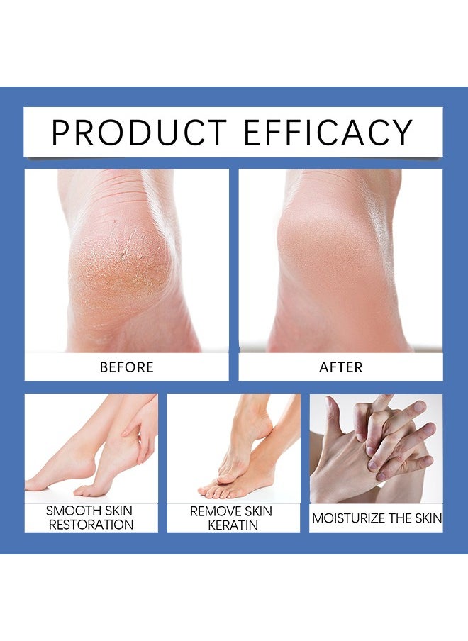 60% Urea Cream Plus 2% Salicylic-Acid Foot Cream - Urea Cream for Feet Moisturizer for Dry Cracked Feet Knees Elbows Hands - Heel Balm Stick Aloe Vera, Beeswax, Urea Foot Cream Smoothing Skin 40g