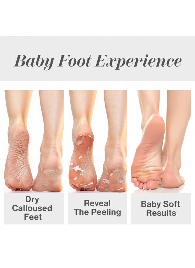 Baby Foot Peel Mask-Original Exfoliant Foot Peel-Callus Remover for Rough Cracked Dry Feet-Dead Skin Remove-Foot Peeling Mask for Baby Soft Feet