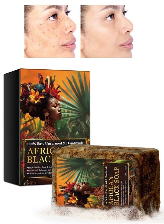 100g African Black Soap for Face and Body Wash with Shea Butter Fade Dark Spots and Acne Spots Anti Aging Hydrates Balance Oily Skin 100% Raw Organic Unrefined and Handmade African Black Soap