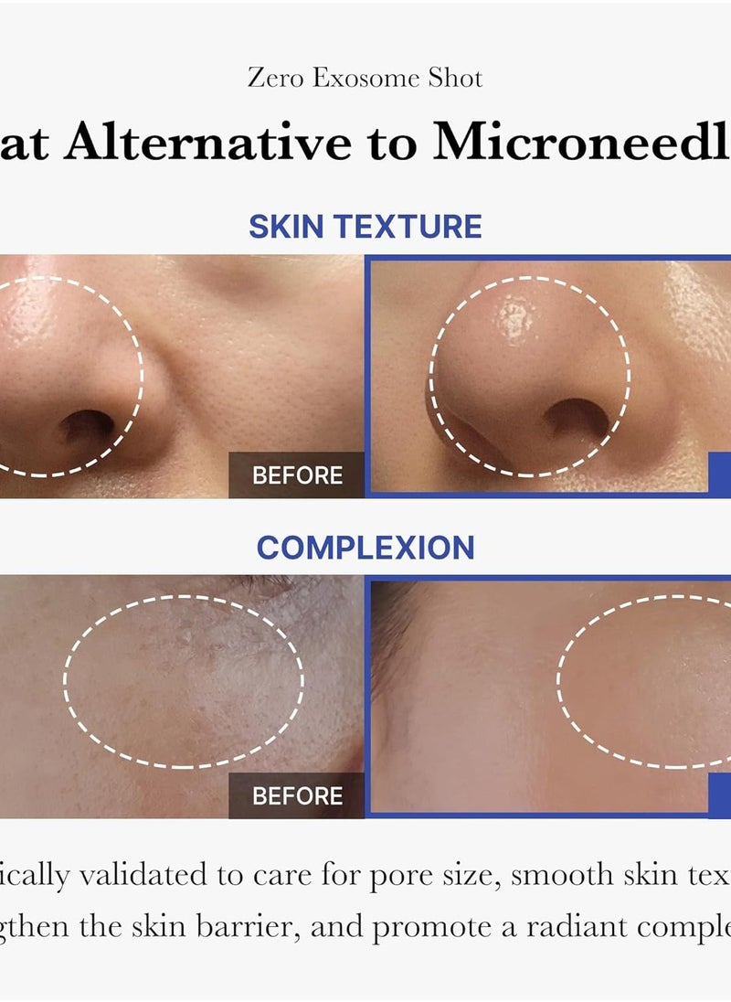 Medicube Zero Exosome Shot 7,500 PPM Spicule Facial Serum | Liquid Skin Booster Serum | Exosome, AHA+BHA+PHA | Pore Care, Dead Skin Cells, Skin Texture |...