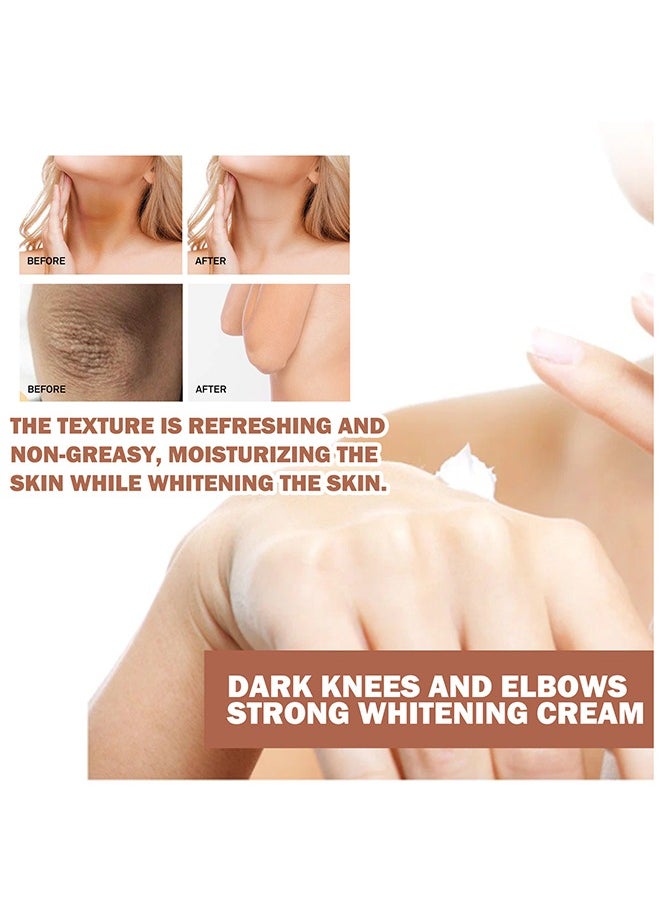 Dark Knees And Elbows Strong Whitening Cream, Whitening Body Lotion, Intimate Area Whitening Cream, Dark Spot Correcting Cream For All Skin Types