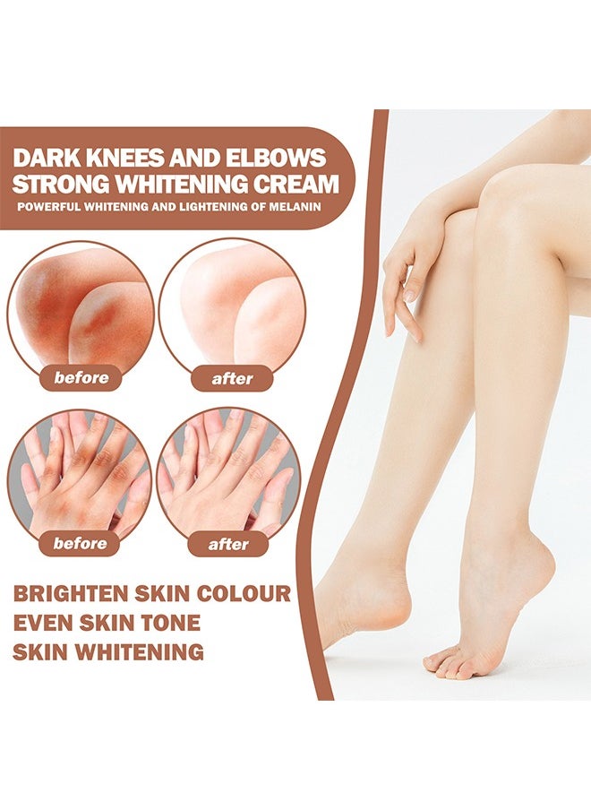 Dark Knees And Elbows Strong Whitening Cream, Whitening Body Lotion, Intimate Area Whitening Cream, Dark Spot Correcting Cream For All Skin Types