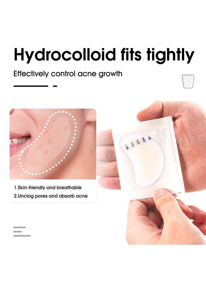 Hydrocolloid Acne Patch(20 Patches), Large Spot Control Cover With Long Size, Extra Larger Acne Pimple Patch For Covering Large Breakouts, Spot Patch, Stickers For Body, Cheek, Forehead, And Chin