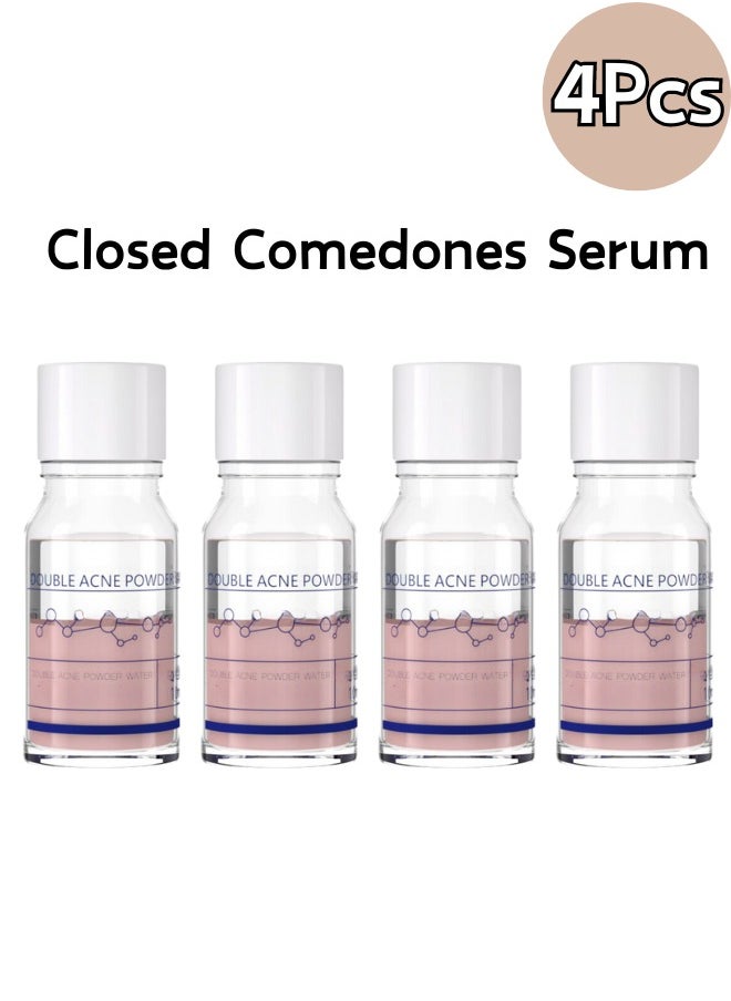 4 Pcs of Closed Comedones Essence to Remove Acne Reduce Acne Marks Remove Closed Comedones Repair Skin