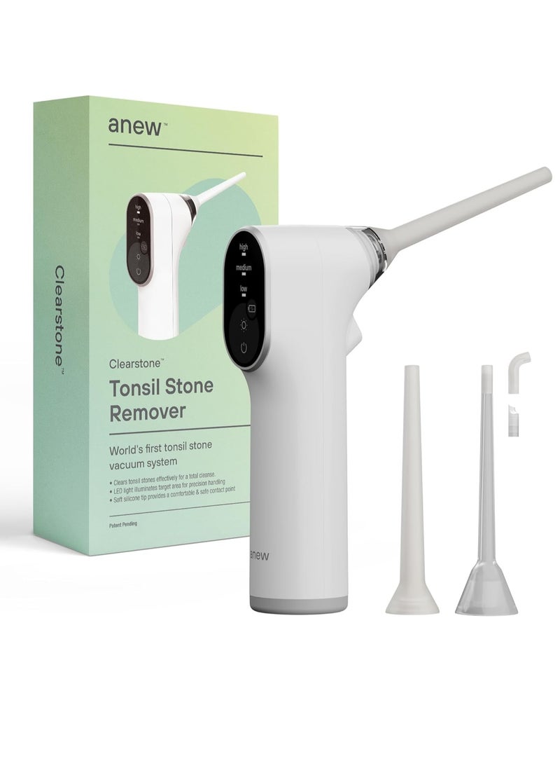 Electronic Vacuum Tonsil Stone Remover with LED Guidance Light - Hassle-Free Instant Suction - Tonsil Stone Removal Kit - Patent Pending (White)