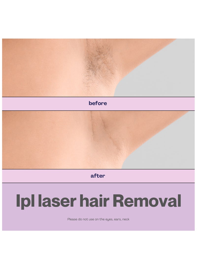 ONE32 | IPL laser hair removal device | Epilator for women | At-home laser hair removal for women | Complete body hair removal device | Comes with 990,000 flashes, 5 intensity levels, and auto mode