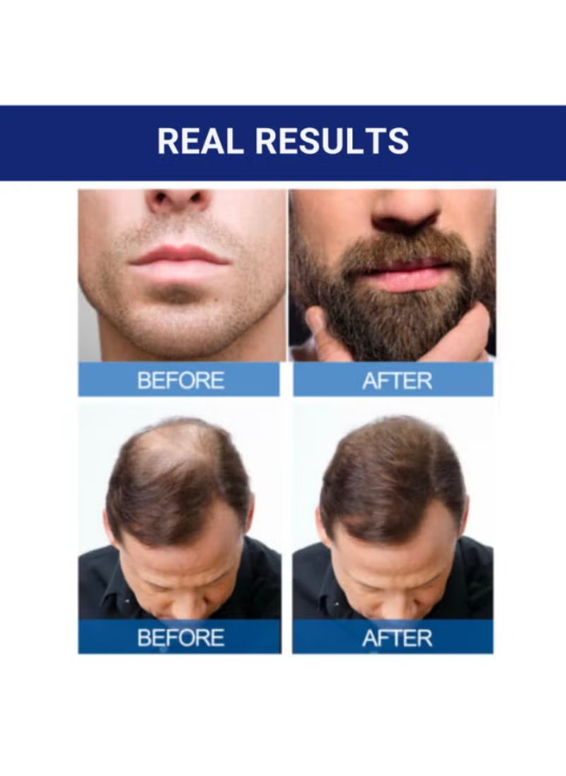 6 Bottles of Minoxidil 5% Extra Strength Hair Regrowth Solution – 60ml Each