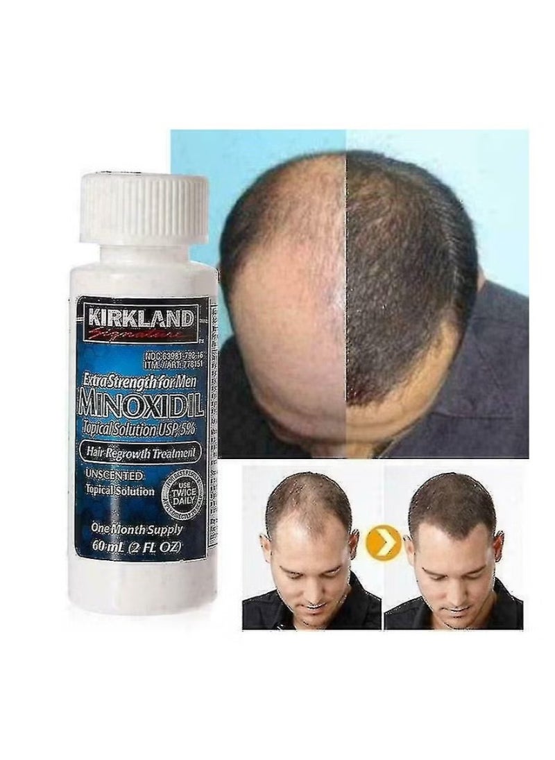 Kirkland Minoxidil 5% Extra Strength Liquid – 3-Month Supply for Men, 180ml Total