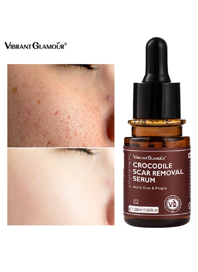 Crocodile scar removal serum, crocodile scar removal serum, pigmented acne treatment stretch mark removal (30ml)