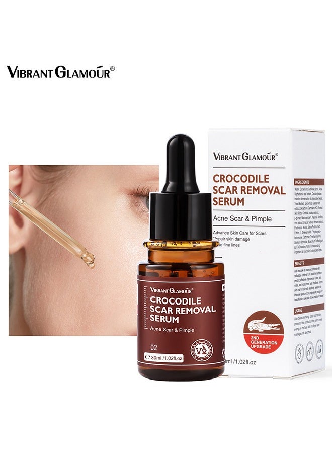 Crocodile scar removal serum, crocodile scar removal serum, pigmented acne treatment stretch mark removal (30ml)