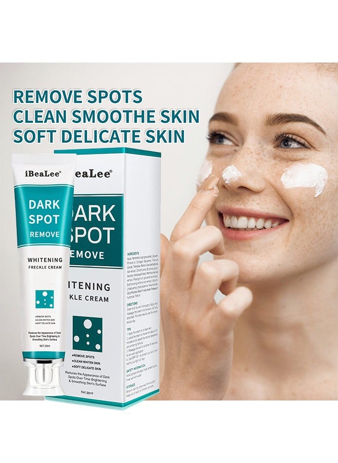 Dark Spot Remove Whitening Freckle Cream, for Face Peeling Skin Whitening Freckle Cream Pigmentation Treatment Sun Spots Age Spots Blemish Remover Lightening Cream