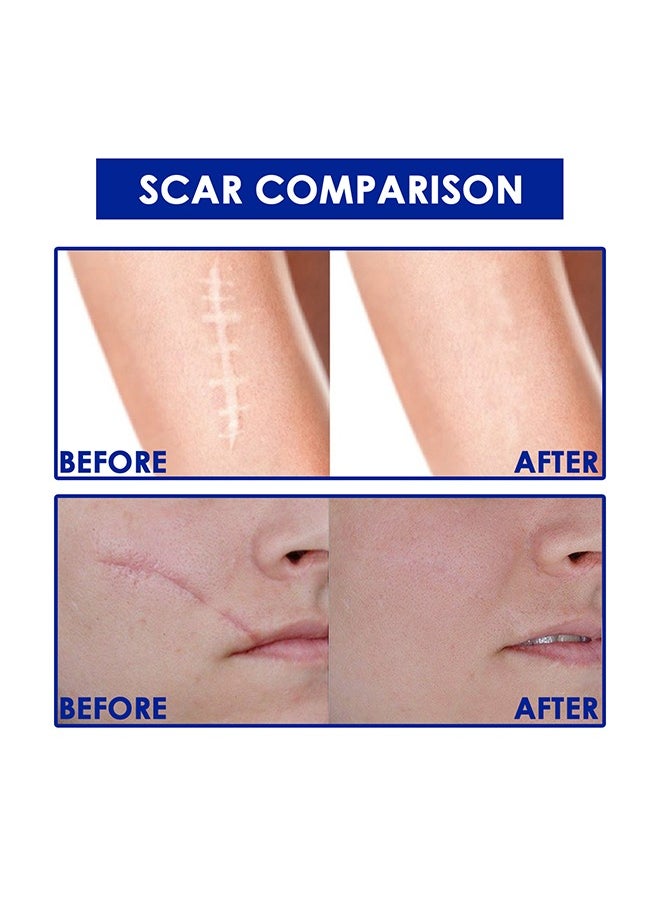 Advanced Scar Formula with Innovative CPX Technology and Unique Vitamin C Ester, Advanced Scar Gel 15g For Cosmetic Improvement of Scars, Fast Drying and Unique Silicone Gel Formulation, Used For Treatment of Keloids, Surgical and Hypertrophic Scars, Suitable For Sensitive Skin