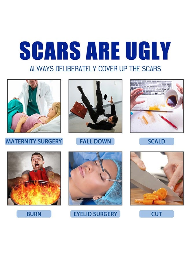 Advanced Scar Formula with Innovative CPX Technology and Unique Vitamin C Ester, Advanced Scar Gel 15g For Cosmetic Improvement of Scars, Fast Drying and Unique Silicone Gel Formulation, Used For Treatment of Keloids, Surgical and Hypertrophic Scars, Suitable For Sensitive Skin