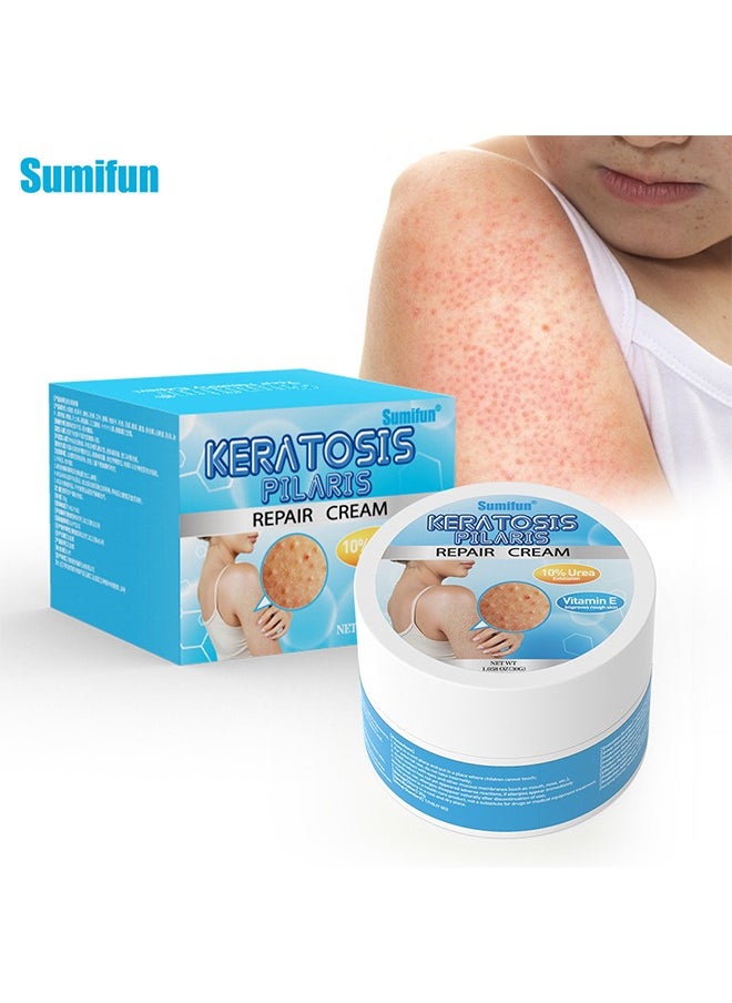 Keratosis Pilaris Repair Cream,Vitamin E cream, urea to remove dead skin cells 30g